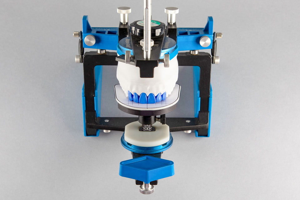 Figure 22 - Diagnostic Wax-Up on Panadent Semi-Adjustable Articulator (Front View).