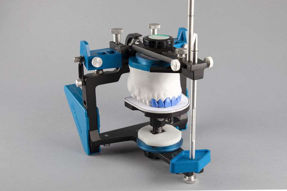 Figure 23 - Diagnostic Wax-Up mounted on Panadent Semi-Adjustable Articulator (Side View).